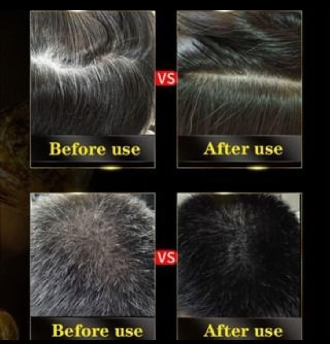 Black Hair Dye Shampoo-3 in 1 Moisturiser, Shiny and Healthy Hair-Pack of 2
